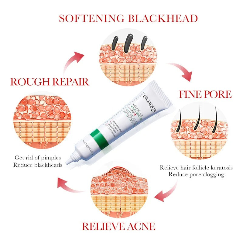 BIOAQUA Salicylic Acid Acne Repair Cream